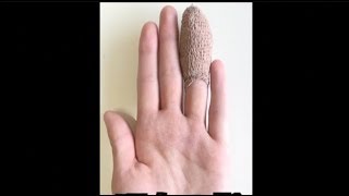 手が動かなくなった。妹と死にかけた3年前