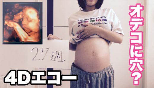 17歳の妊婦４Ｄエコー２７週目【妊娠】【赤ちゃん】【baby】オデコに穴？経過報告【孫】【妊婦】