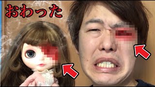 【呪いの人形】人形の片目を壊したら自分もケガしました…さすがにやばいです…
