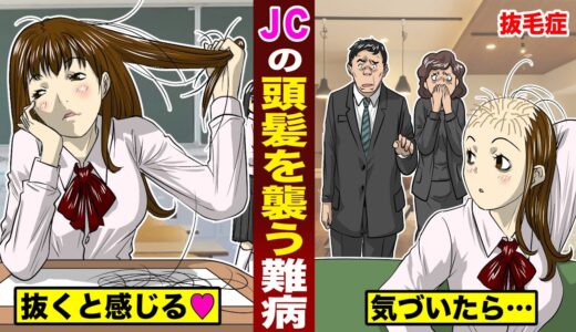 【抜毛症】気がついたら…ハゲていた女子中学生。無意識に髪を抜く難病。「気持ちぃ」