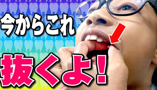 歯がグラグラ…抜きたい！でも痛い…でもやっぱり抜きたい！葛藤と挑戦の連続！小4女子の戦い２日目に密着！