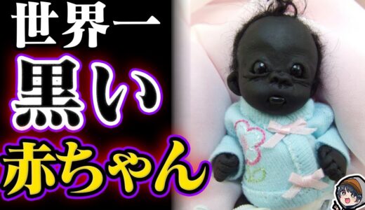 【衝撃】世界で1番黒い赤ちゃんがヤバい
