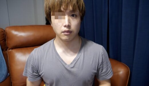僕の右目についてお伝えしなければいけない事があります。