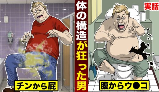 【実話】体の構造が狂った男。チンから屁...腹からウ●コ。
