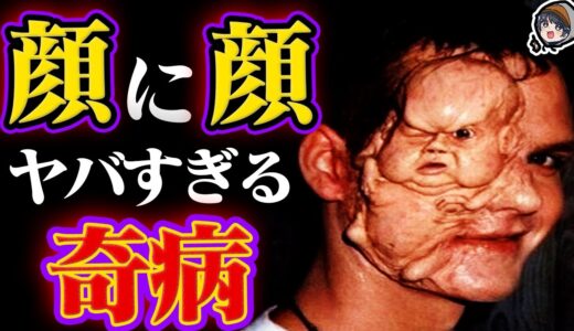【衝撃】顔に顔ができる奇病。人面瘡がヤバい【都市伝説】