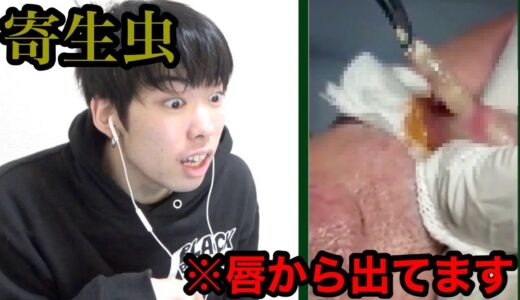 【閲覧注意】気持ち悪い寄生虫を取り出す動画がエグすぎる