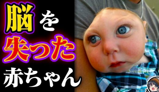 【実話】脳がない状態で生まれた奇跡の子