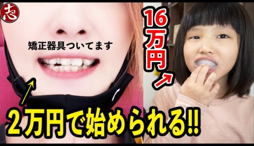 【歯の矯正】キレイラインってのが流行っているので実際に行ってみた！！