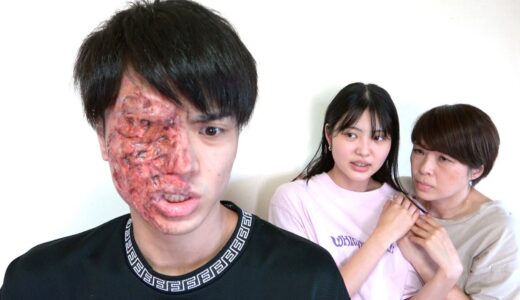 兄の顔が病気。無理限界。妹と動画撮れません