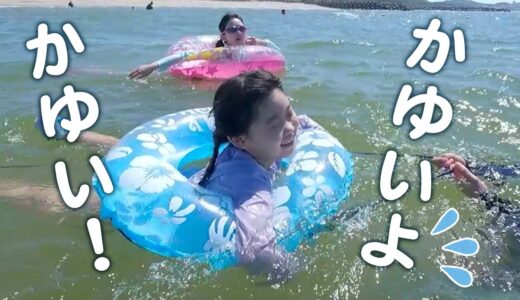 家族で海に来たら生まれて初めてクラゲに刺された