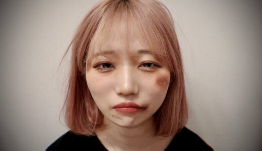 顔のアザと涙の理由。