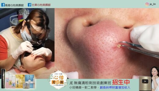 Je無痛清粉刺-鼻子美莉果採收-高雄心怡美顏館-黃嘉宣老師-做臉均一價1500元 不包卡 無推銷 歡迎粉專預約